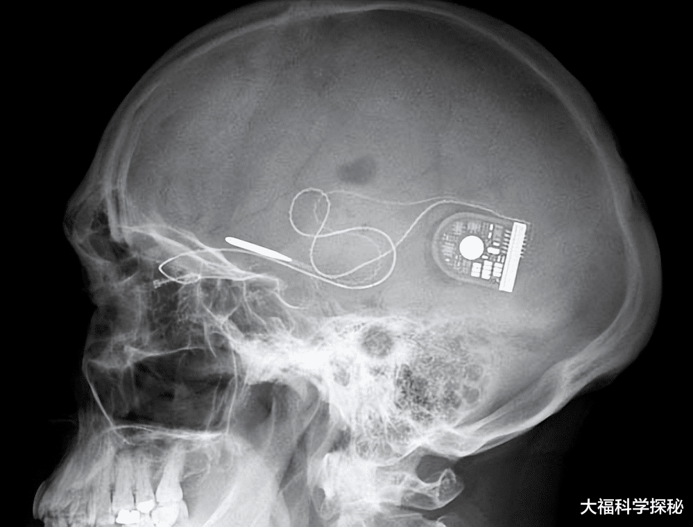 外星人真的存在吗?女子声称被外星人绑架136年,后被送回地球