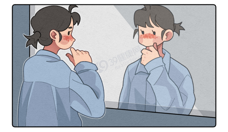 系统性红斑狼疮|皮肤突然长红斑？当心已被“不死癌症”盯上，出现这些表现请警惕