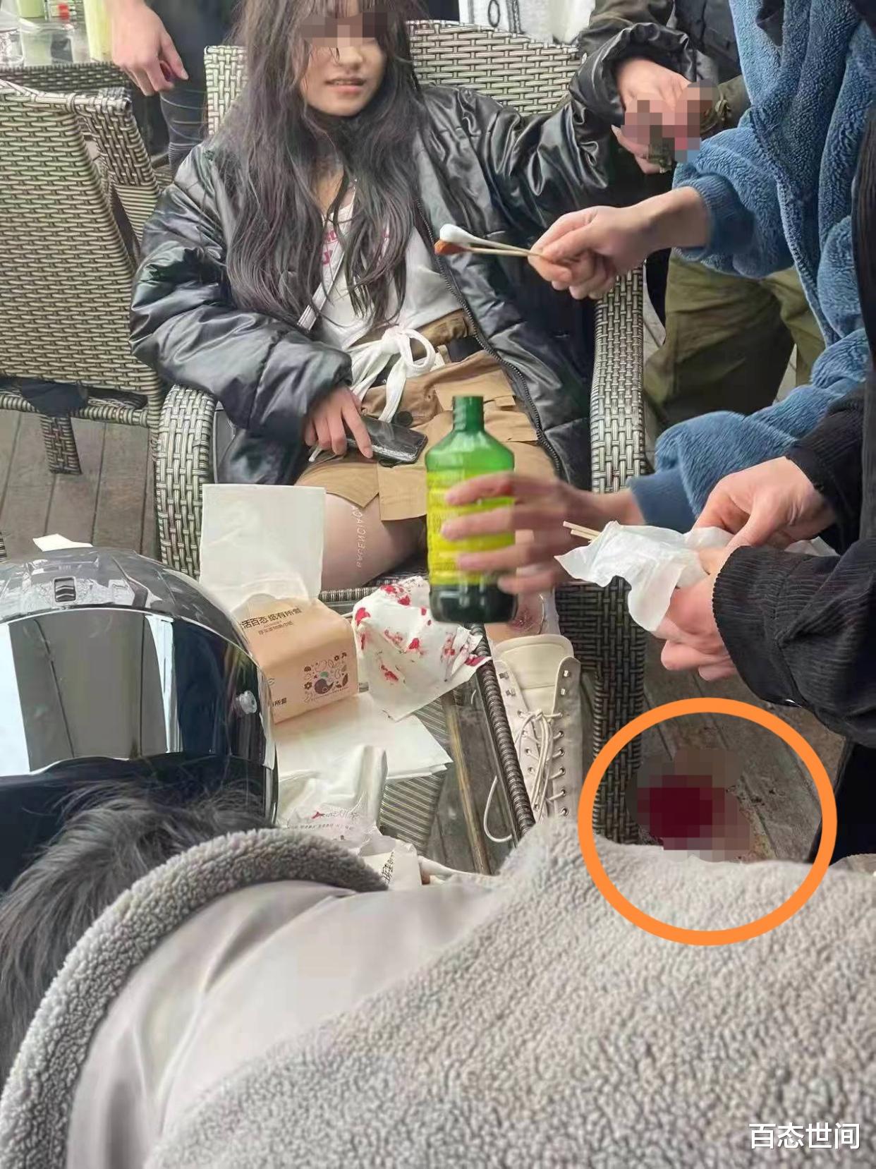 成都俩女孩光腿坐摩托压弯时侧滑,身体与路面激烈摩擦,血肉模糊