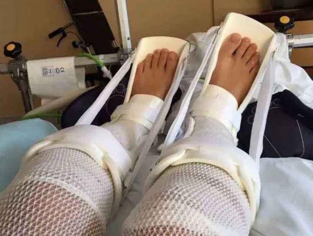 迪士尼|曾花16万断骨,只为长高7.2厘米的李亚诺,如今与后遗症为伴