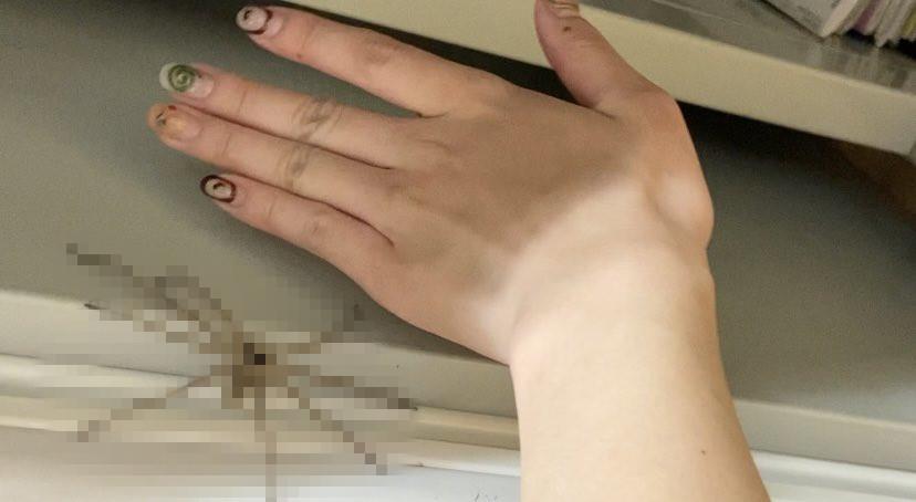 日本妹子收集吸过自己血的蚊子，把血抽干做成...