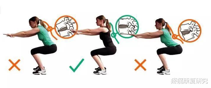 运动|肌肉失衡模式的经典动作评估与分析