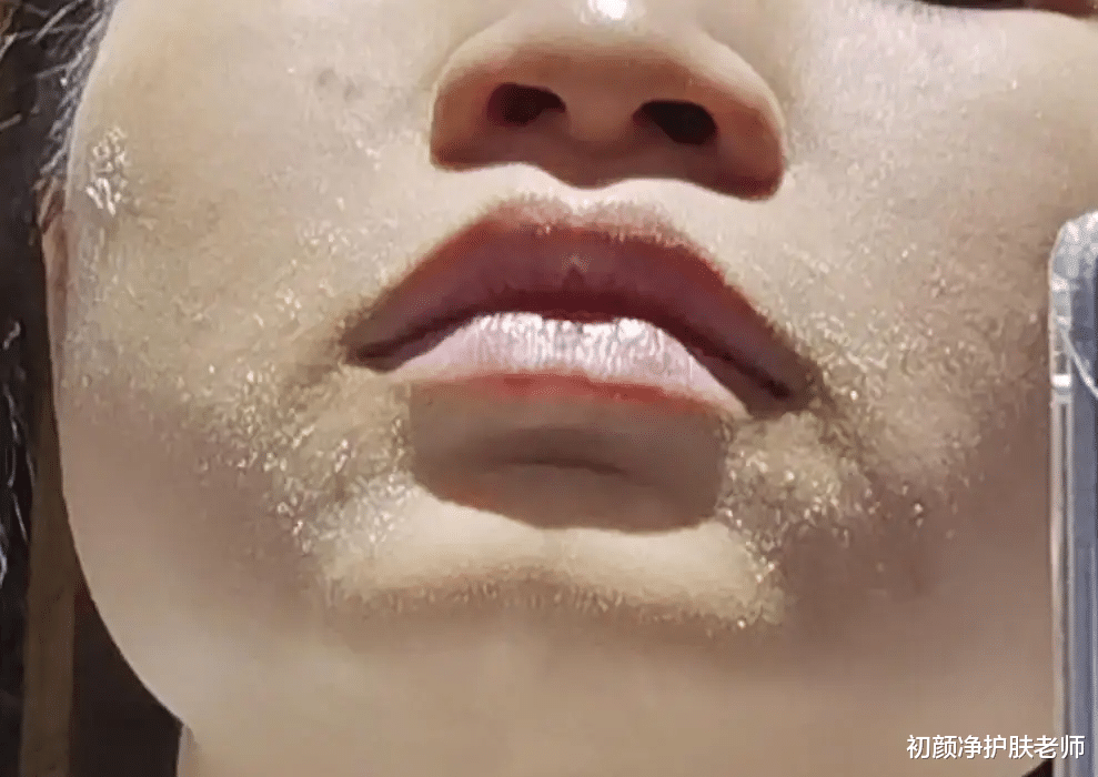 渔夫帽 皮肤屏障受损,你的保湿真的做对了吗?