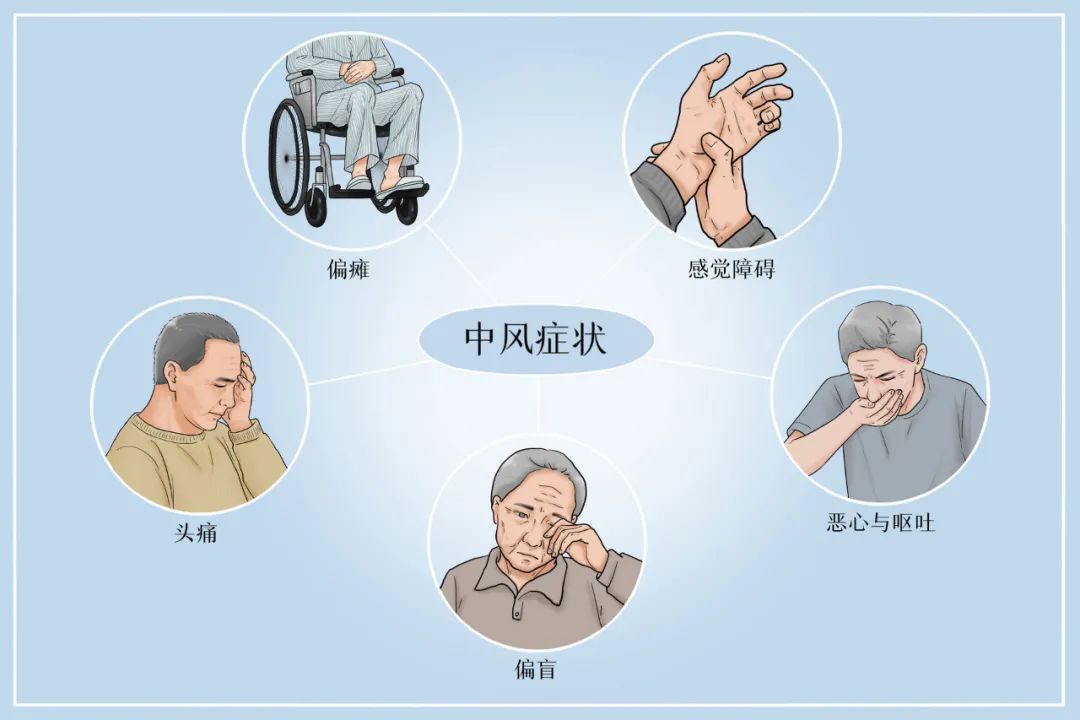 研究丨间充质干细胞治疗缺血性卒中的新替代方案