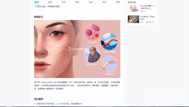 马尾辫 美容美发店治“扁平疣”?小伙两个月花了34万余元|解忧帮