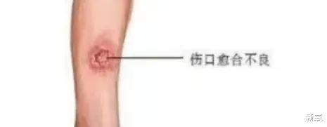 女孩 又一个女明星上热搜被嘲身材,你还记得她吗?