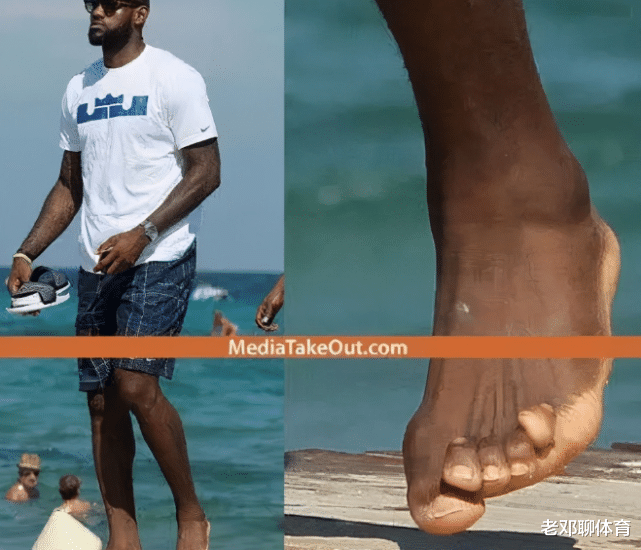 奥尼尔|看了NBA球星的脚 你就不会羡慕他们亿万资产！奥尼尔脚似ET