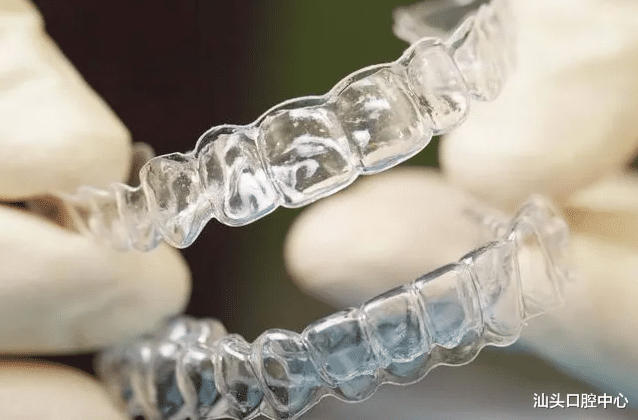 疫苗|未成年人牙齿矫正,能不能戴隐形牙套?