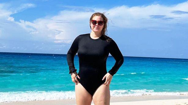 抽脂|外国女星艾米·舒默抽脂减肥，并在采访中大方公开，真实不隐瞒