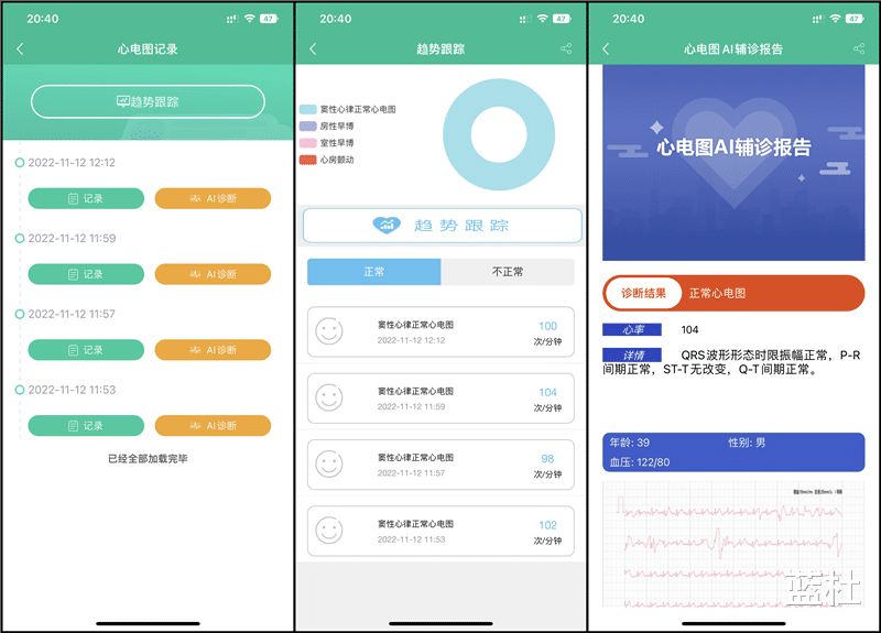 PHP|dido E10专业级测血压智能手表,你的贴身医护保镖