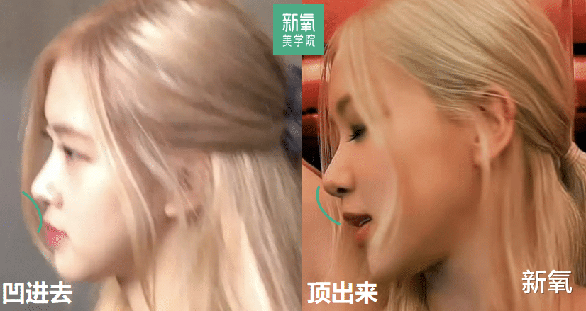 童星|“最美童星”ellagross，到底美了还是丑了？