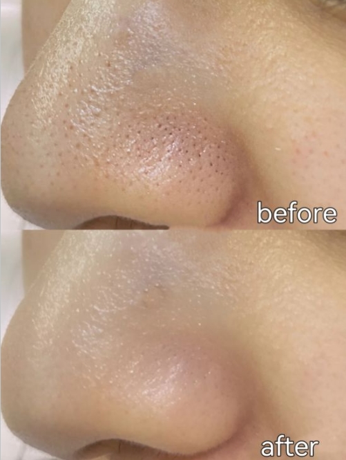 护肤品 买护肤品“求精不求多”,常备这6款老国货,皮肤水嫩有光泽