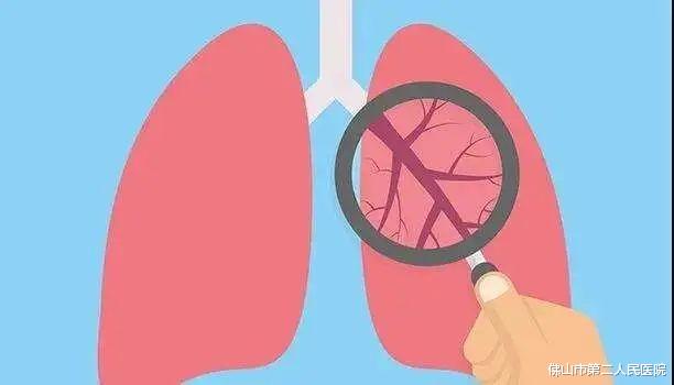 慢阻肺|世界慢阻肺日 | 多走几步就气喘吁吁、经常咳嗽、黄脓痰，警惕慢阻肺