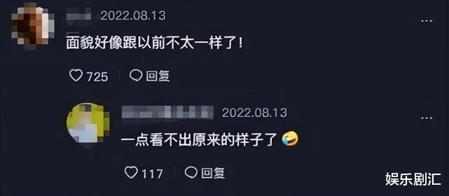 毛衣 倪萍脸部浮肿，嘴唇变厚，夏天穿毛衣，网友说：健康方面有问题？