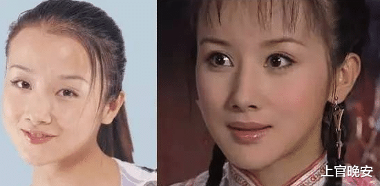 娱乐圈|娱乐圈明星们的假鼻子，真的绝了！都是狠人