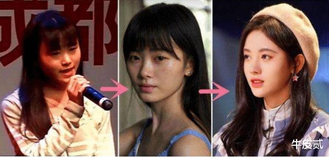 姐姐|明明“优雅自然”,却偏要“硅胶脸”的5大女星,个个苦不堪言