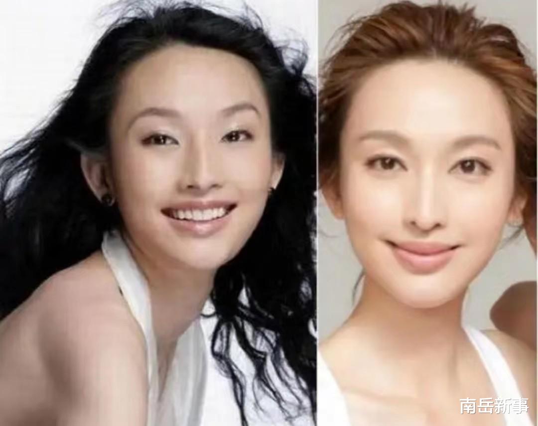 整容|整容、打针、过度减肥,9位浪姐为美太疯狂,面部僵硬认不出