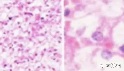 面膜|果然，女星初恋纯欲天花板还是得看她