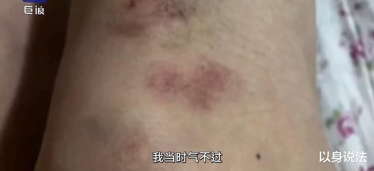 浙江台州，KTV女服务员因拒绝喝下1箱半啤酒被客人殴打