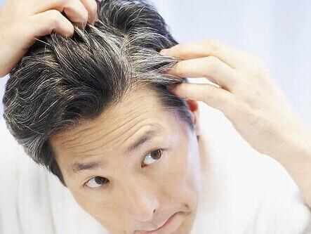 发型 才45岁头发就白了一半，纠结染还是不染？有什么好的建议吗？