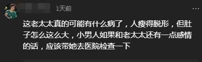 李玉成|85岁马玉琴被指肚大如球,李玉成蹦跳难掩好心情,网友:快去医院