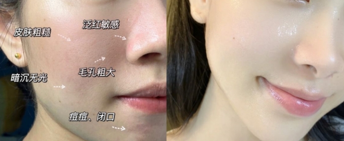 孕期 孕期换皮大法！孕期护肤品坚持“3不要”护肤、养胎两不误