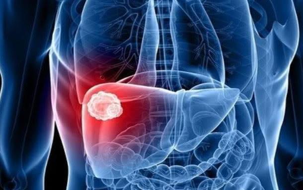 肝脏|肝若不好，手脚可能提前亮起4个“红灯”，早知，早养，早好