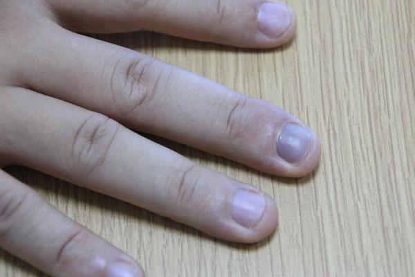 水果|肾不好、肾虚的人，手脚大多有这4个“特性”，一个不占要恭喜！