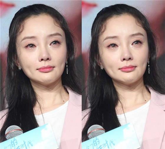 白梦妍|看到整容失败的明星，你还会去整容吗