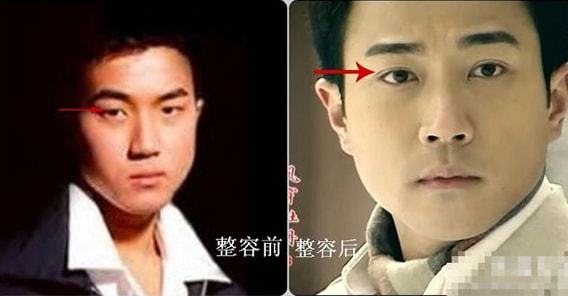 成龙|基因骗不了人!5位明星动脸“改命”,孩子却跟他们整容前一样