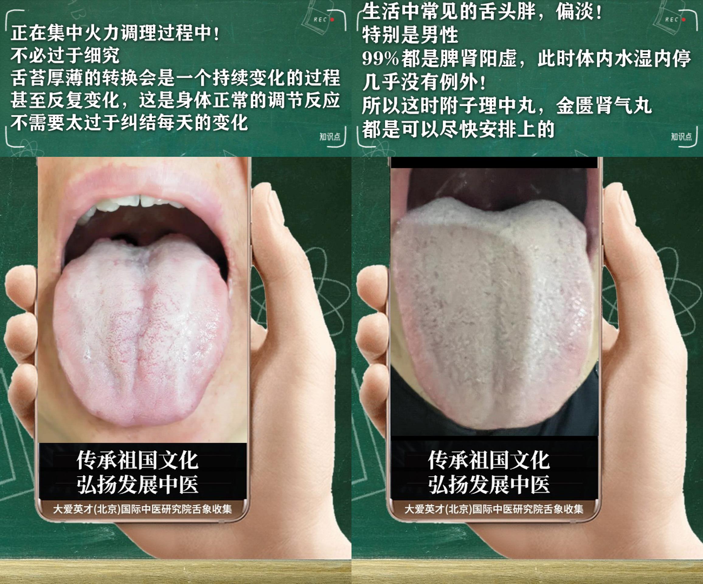 衰老|中医解剖:容易悲伤多虑,湿重痰多,反复胃胀,纳呆