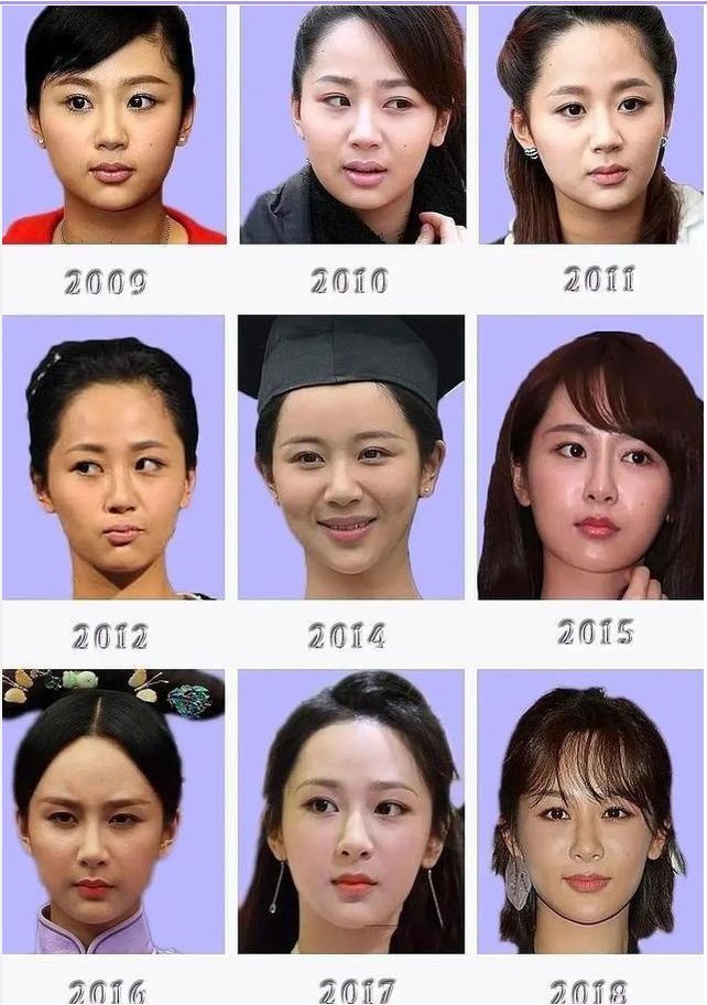 景甜|《余生》正在热播,杨紫下巴凹陷回弹,网友:能换个好的医生吗?