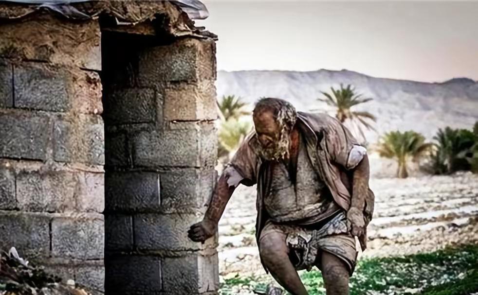 祖传秘方|“全球最脏的人”洗澡后病亡，67年不洗澡活到94，长寿秘诀很惊心