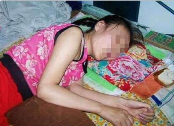 1989年,女孩被哥哥打2巴掌,“瘫痪”在床20年,被监控“打脸”