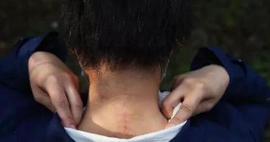 “八达岭老虎咬人事件”5年之后,活下来的女人后来究竟怎样了?