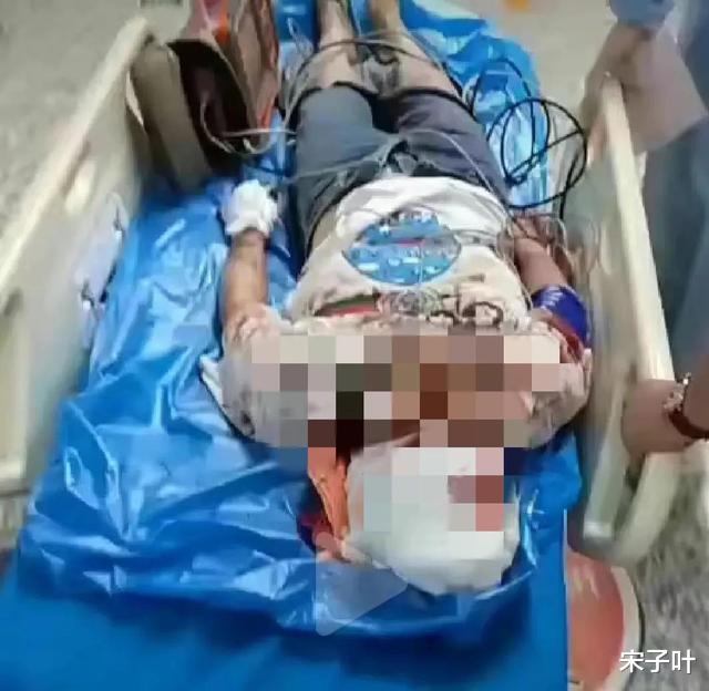唐山烧烤店女子惨遭群殴事件的前因后果,女性该如何保护自己