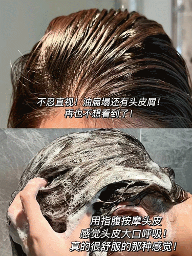 玻尿酸 某大牌800多的洗发水是抢钱吗？国产玻尿酸大佬看不下去了