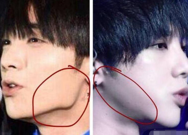 汤唯|8位“改头换命”的男明星，王一博脸已僵硬，刘恺威眼皮才是灵魂