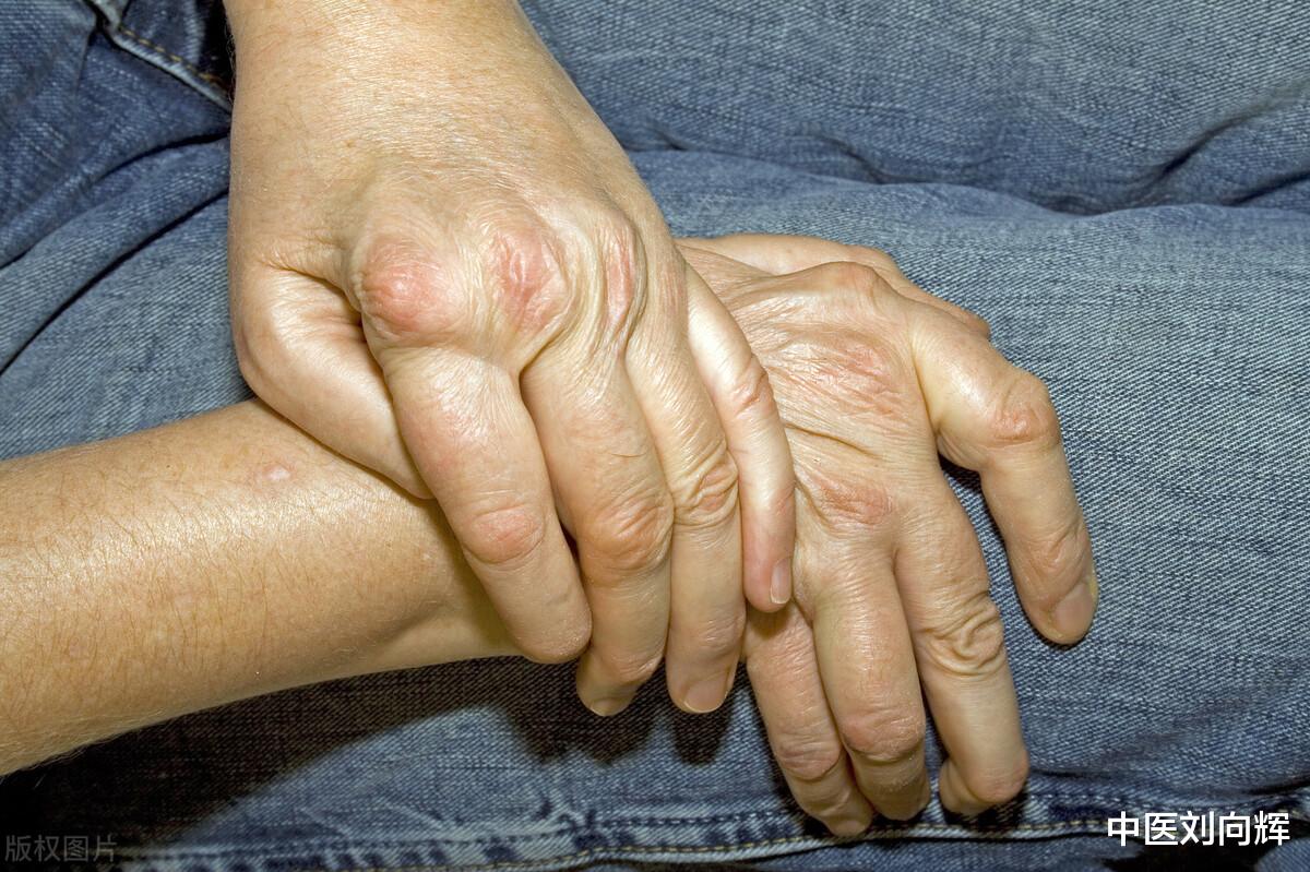 支气管炎|体内毒素有哪些?寒积、气积、痰积、血积、食积!一个名方消五积