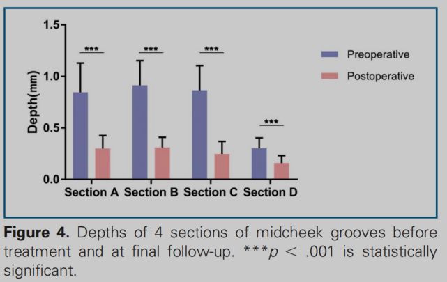 熊师:印第安纹的解剖学特点与治疗进展丨专业视点