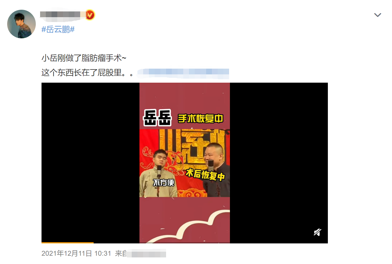 张艺兴|岳云鹏患脂肪瘤后暴瘦！瘦出尖下巴肚腩消失，疑无缘虎年央视春晚