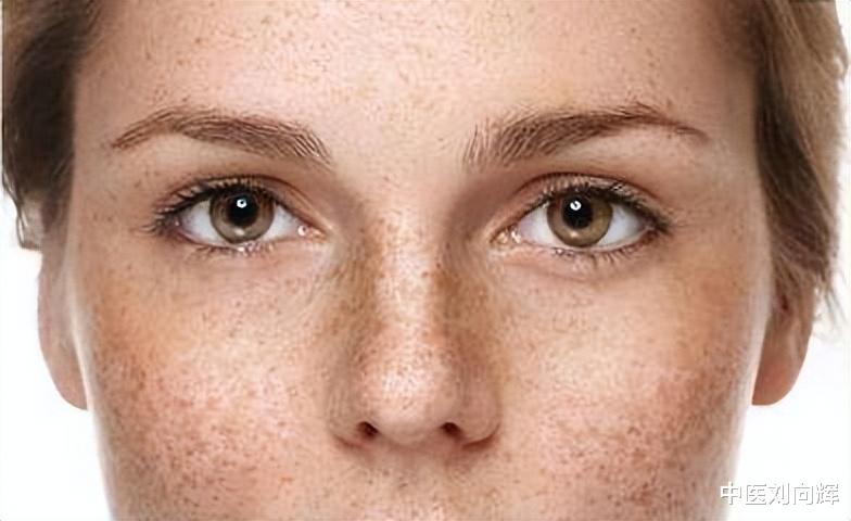 |血虚脸色暗 血瘀脸长斑,一个奇方佛手散,养血化瘀,祛淡斑 养气色