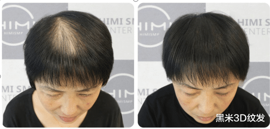 杜海涛 脱发初级攻略，如何寻找一瓶好用的洗发水？