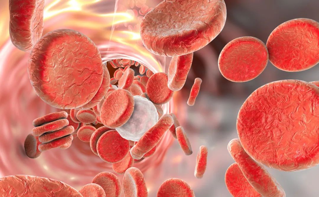 |血管堵塞的人，身体大多会有这3个表现，日常需留心观察