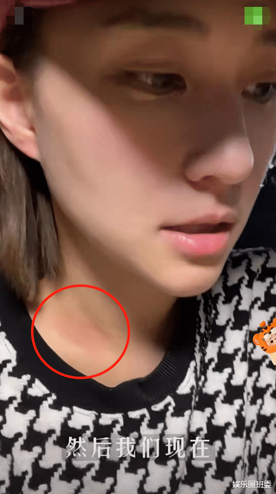 何超莲|何超莲带窦骁吃大排档，脖子草莓印抢镜，疑似曝光赵雅芝小儿子恋情