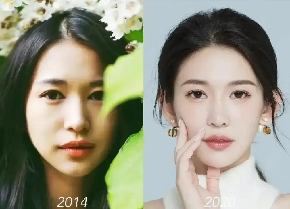 整容|14年美容史，网红湾湾整容前后对比，曾经诸多言论，让人忧心三观