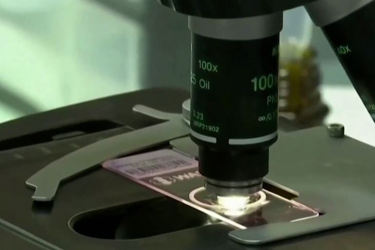 大脑|以色列记录首例猴痘病例 世卫组织预计会有更多病例 !