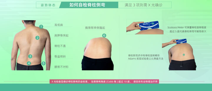 脊柱侧凸|脊柱侧弯了,运动时应该注意什么?