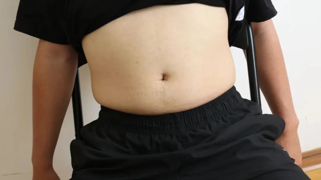 高血压|为何痛风也会“重男轻女”呢？这3大因素或是痛风偏爱男性的原因