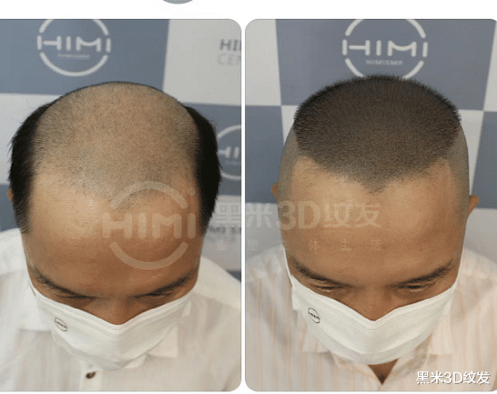 中成药|纹发可预见性操作，不是随意纹，远没有你想的那么简单！